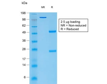 TG Antibody / Thyroglobulin