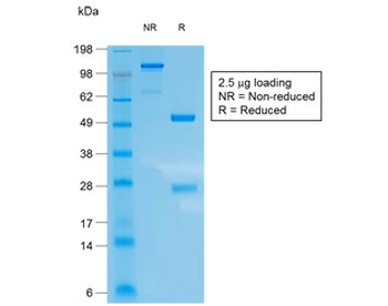 KRT10 Antibody / Cytokeratin 10