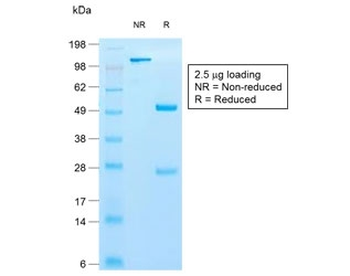 KRT10 Antibody / Cytokeratin 10