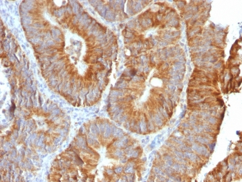 TNFSF15 Antibody / VEGI / TL1A
