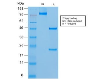 CD146 Antibody / MCAM / MUC18