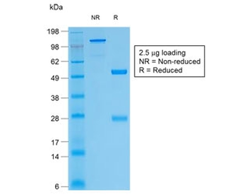 TG Antibody / Thyroglobulin