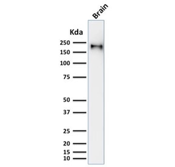Neurofilament Antibody (-Heavy) / NF-H / NEFH