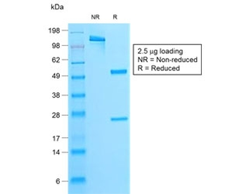 Parathyroid Hormone Antibody / N Terminal