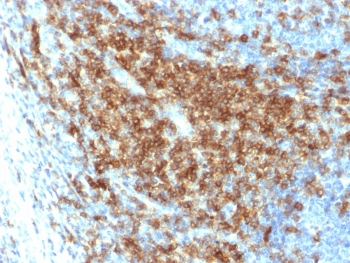 CD43 Antibody