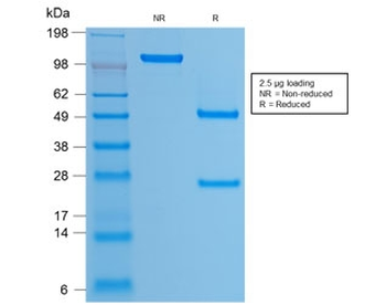 HPV-16 L1 Antibody