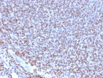 Recombinant NKX2.2 Antibody / Rabbit Monoclonal