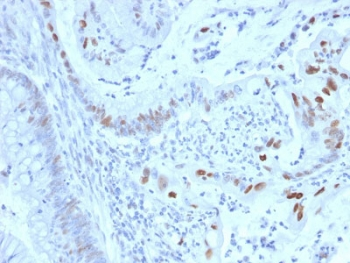 Cyclin E1 Antibody / CCNE1