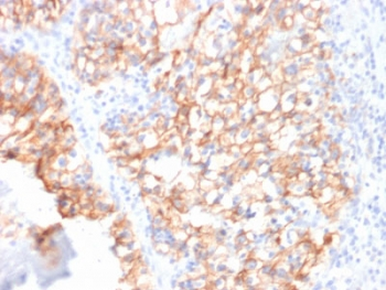 Cadherin 16 Antibody