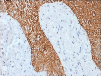 Multi Cytokeratin Antibody