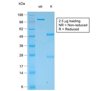 Multi Cytokeratin Antibody