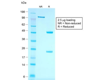 KRT7 Antibody / Cytokeratin 7