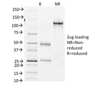 Bcl6 Antibody