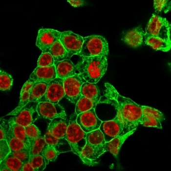 Glypican 3 Antibody / GPC3