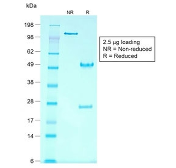 Glypican 3 Antibody / GPC3