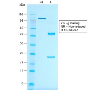 MART-1 / Melan-A Antibody