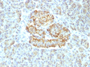 TNF alpha Antibody