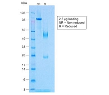 TNF alpha Antibody