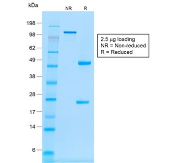 CD20 Antibody