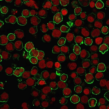 CD20 Antibody
