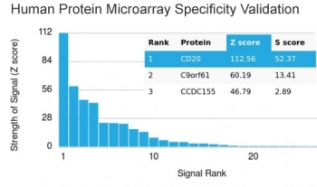 CD20 Antibody