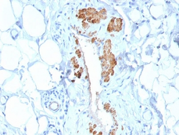 SMMHC Antibody (Smooth Muscle Myosin Heavy Chain)