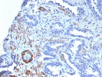 SMMHC Antibody (Smooth Muscle Myosin Heavy Chain)