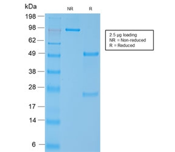 SMMHC Antibody (Smooth Muscle Myosin Heavy Chain)