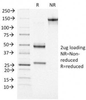 ATRX Antibody / RAD54