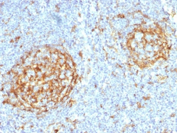 CD14 Antibody (Macrophage Marker)