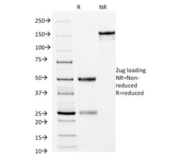 CD14 Antibody (Macrophage Marker)