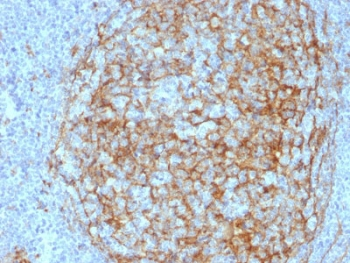 CD14 Antibody