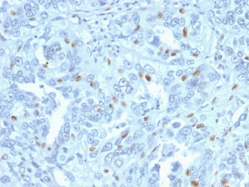 Cyclin A2 Antibody / CCNA2