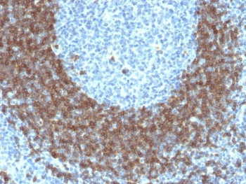 CD79b Antibody