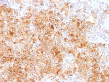 Chromogranin A Antibody