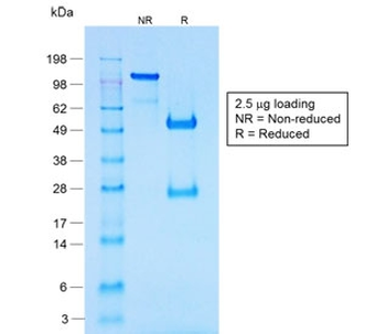 Chromogranin A Antibody