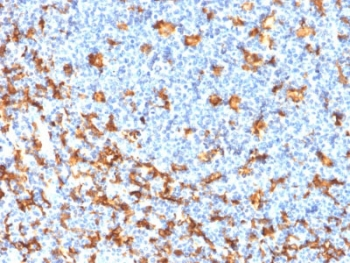 IBA1 Antibody / AIF-1