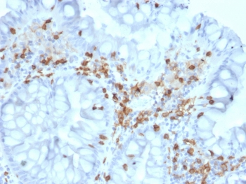 Integrin alpha E Antibody / CD103