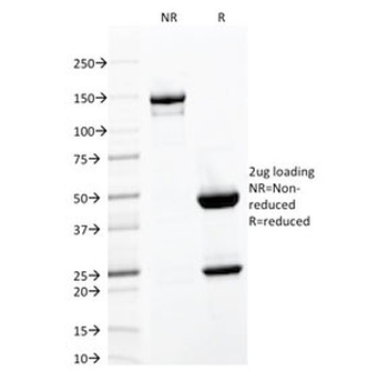 Integrin alpha E Antibody / CD103