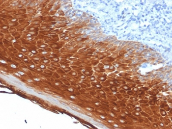 Keratin 6 Antibody / Cytokeratin 6