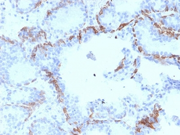 Keratin 6 Antibody / Cytokeratin 6