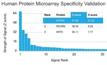 Keratin 6 Antibody / Cytokeratin 6