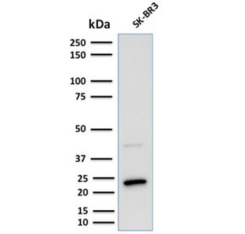 Mammaglobin A Antibody / SCGB2A2