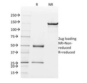 Mammaglobin A Antibody / SCGB2A2