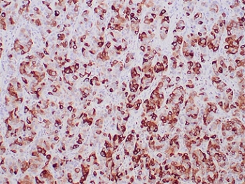 Mammaglobin A Antibody / SCGB2A2