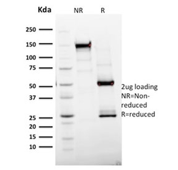 Ki67 Antibody
