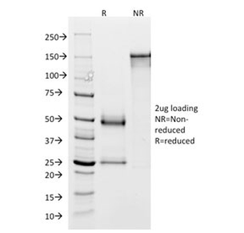 Glycoprotein 2 Antibody / GP2 / ZAP75
