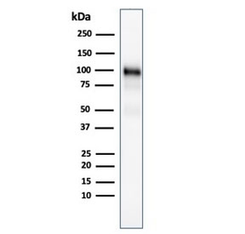 Glycoprotein 2 Antibody / GP2 / ZAP75