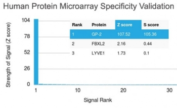Glycoprotein 2 Antibody / GP2 / ZAP75