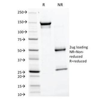 Glycoprotein 2 Antibody / GP2 / ZAP75